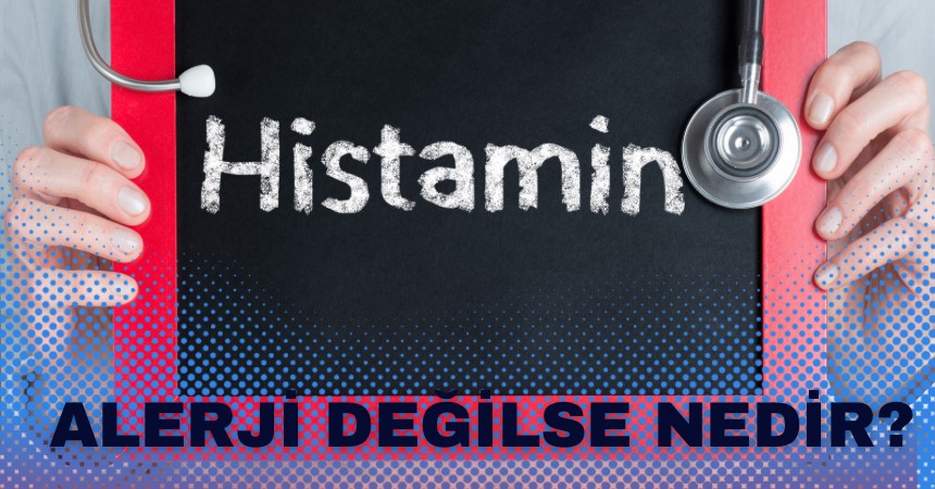Histamin Testi