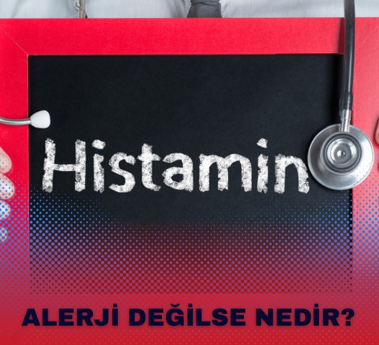 Histamin Testi